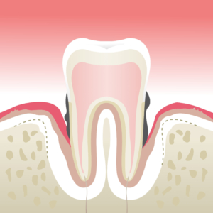 parodontologie givors