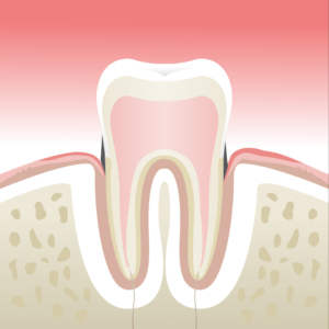 parodontologie st etienne